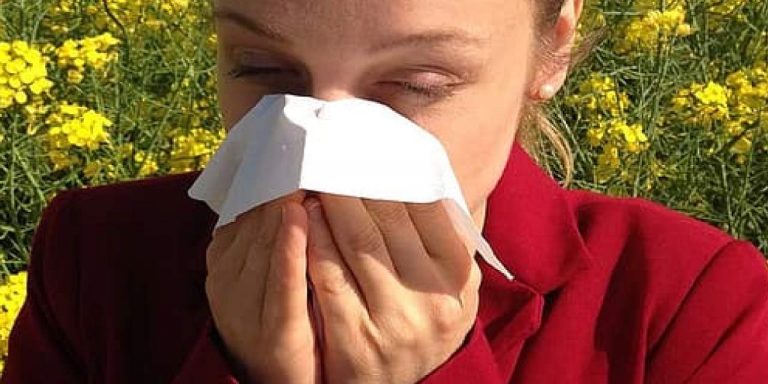 Allergic Rhinitis (Hay Fever) -Signs